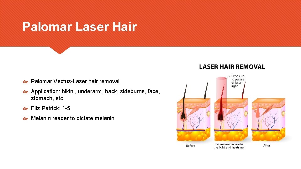 Palomar Laser Hair Palomar Vectus-Laser hair removal Application: bikini, underarm, back, sideburns, face, stomach,