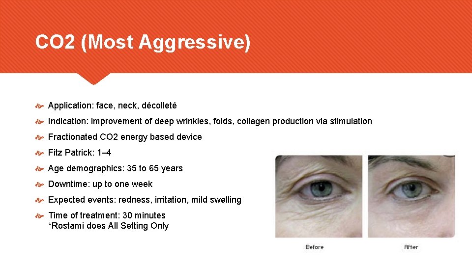 CO 2 (Most Aggressive) Application: face, neck, décolleté Indication: improvement of deep wrinkles, folds,
