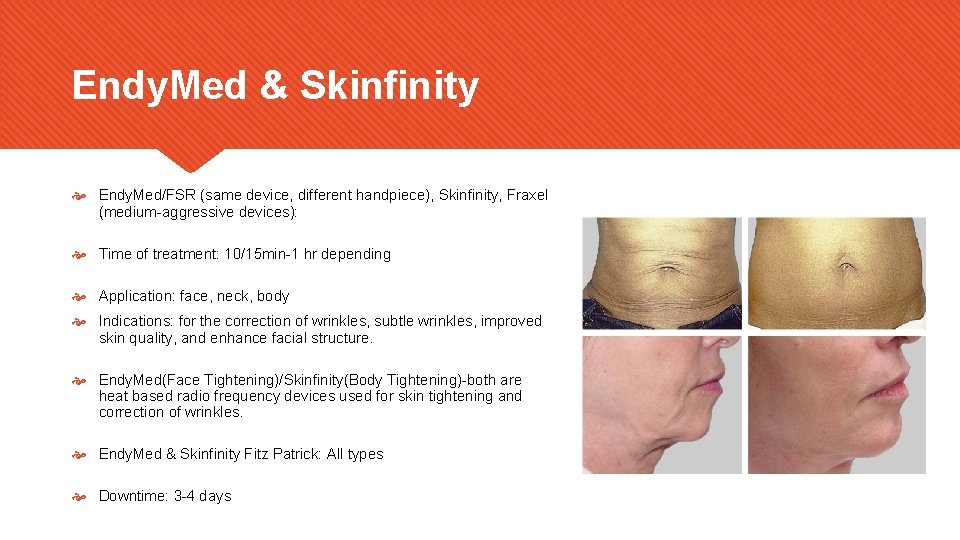 Endy. Med & Skinfinity Endy. Med/FSR (same device, different handpiece), Skinfinity, Fraxel (medium-aggressive devices):