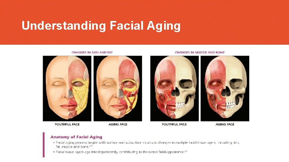 Understanding Facial Aging 