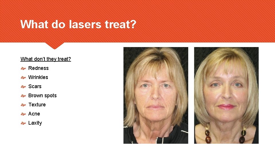 What do lasers treat? What don’t they treat? Redness Wrinkles Scars Brown spots Texture