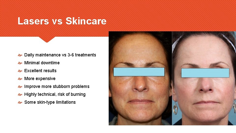 Lasers vs Skincare Daily maintenance vs 3 -6 treatments Minimal downtime Excellent results More