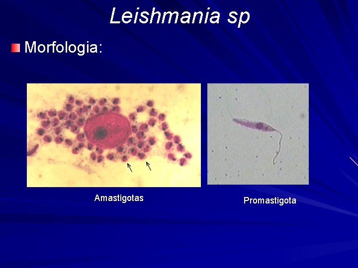 Leishmania sp Morfologia: Amastigotas Promastigota 