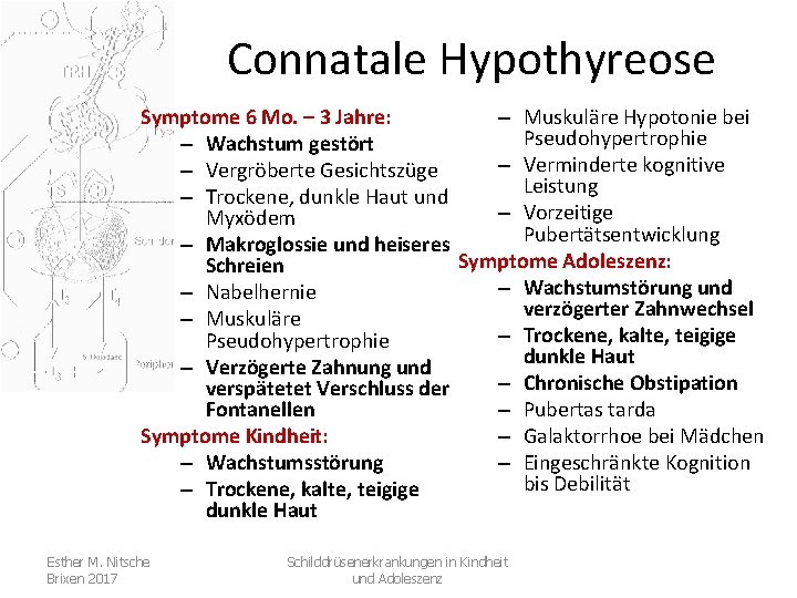 Connatale Hypothyreose Symptome 6 Mo. – 3 Jahre: – Muskuläre Hypotonie bei Pseudohypertrophie –