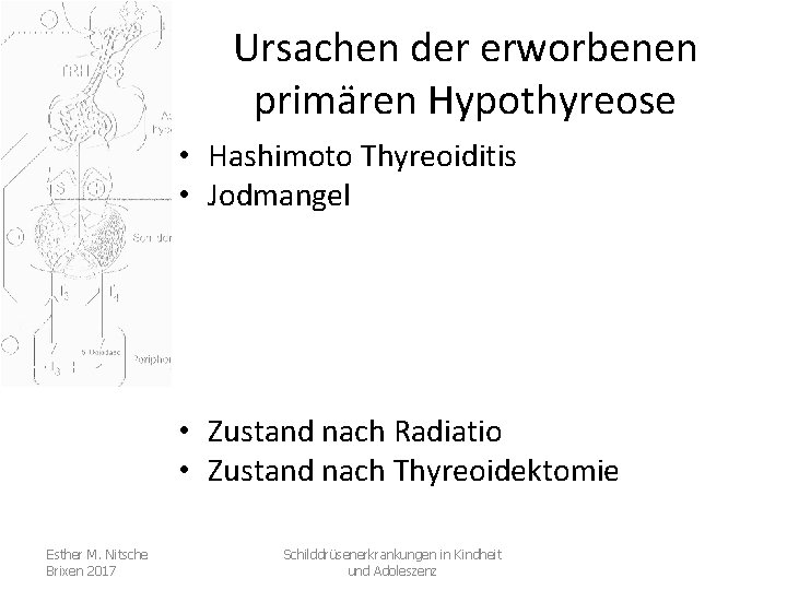 Ursachen der erworbenen primären Hypothyreose • Hashimoto Thyreoiditis • Jodmangel • Zustand nach Radiatio