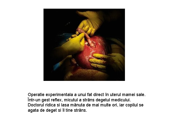 Operatie experimentala a unui fat direct în uterul mamei sale. Într-un gest reflex, micutul