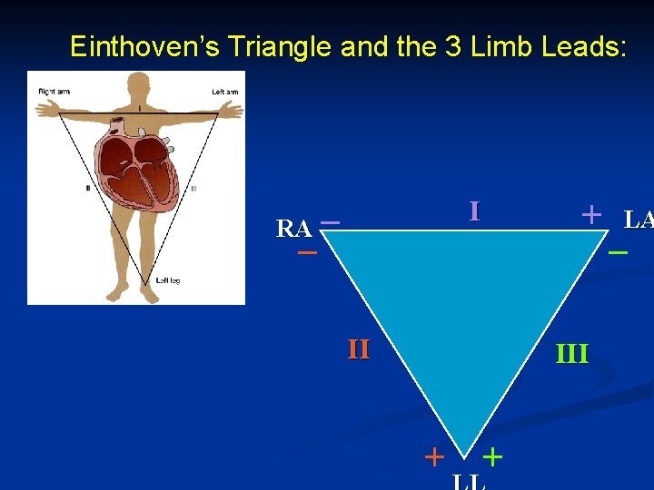 Einthoven’s Triangle and the 3 Limb Leads: + I RA – – II III Einthoven’s Triangle and the 3 Limb Leads: + I RA – – II III