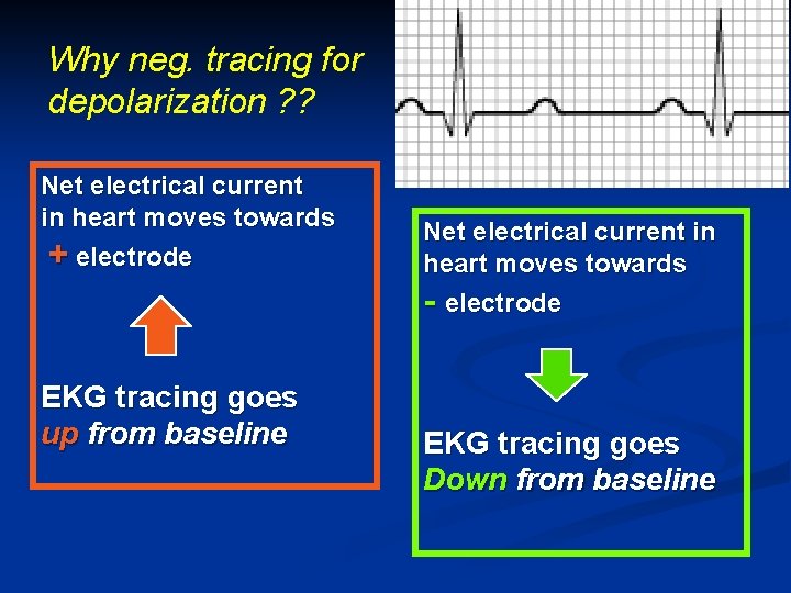 Why neg. tracing for depolarization ? ? Net electrical current in heart moves towards Why neg. tracing for depolarization ? ? Net electrical current in heart moves towards