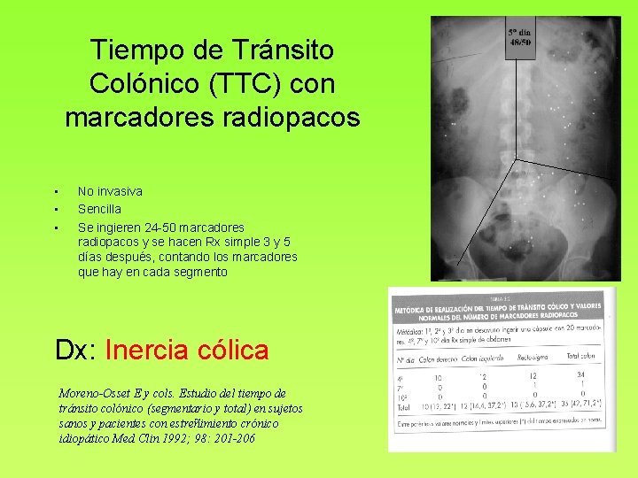 Tiempo de Tránsito Colónico (TTC) con marcadores radiopacos • • • No invasiva Sencilla