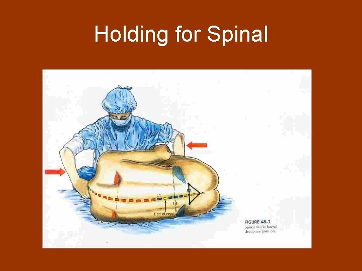 Holding for Spinal 