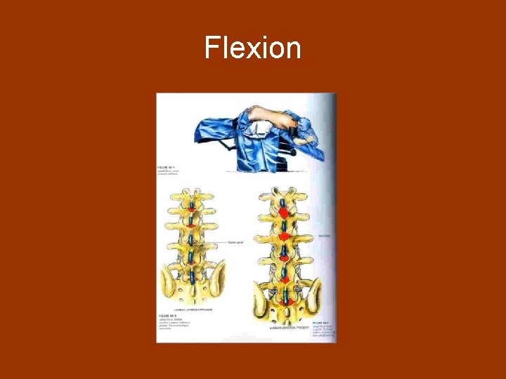 Flexion 