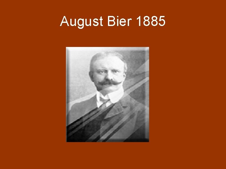 August Bier 1885 