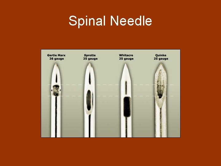 Spinal Needle 