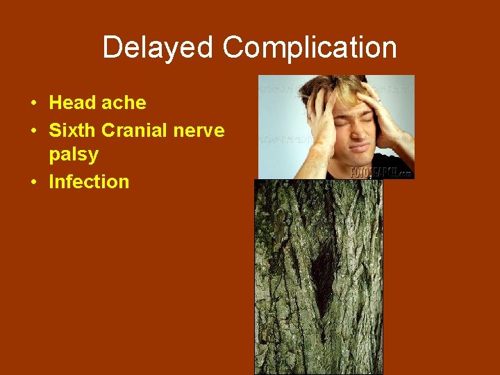 Delayed Complication • Head ache • Sixth Cranial nerve palsy • Infection 