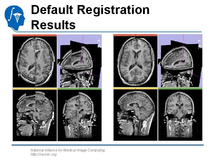 Default Registration Results National Alliance for Medical Image Computing http: //na-mic. org 