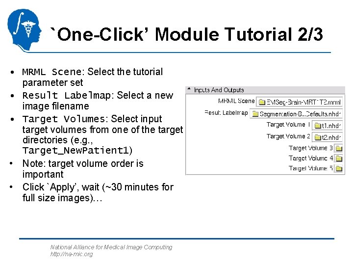 `One-Click’ Module Tutorial 2/3 • MRML Scene: Select the tutorial parameter set • Result