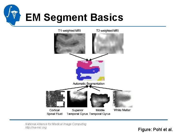 EM Segment Basics National Alliance for Medical Image Computing http: //na-mic. org Figure: Pohl