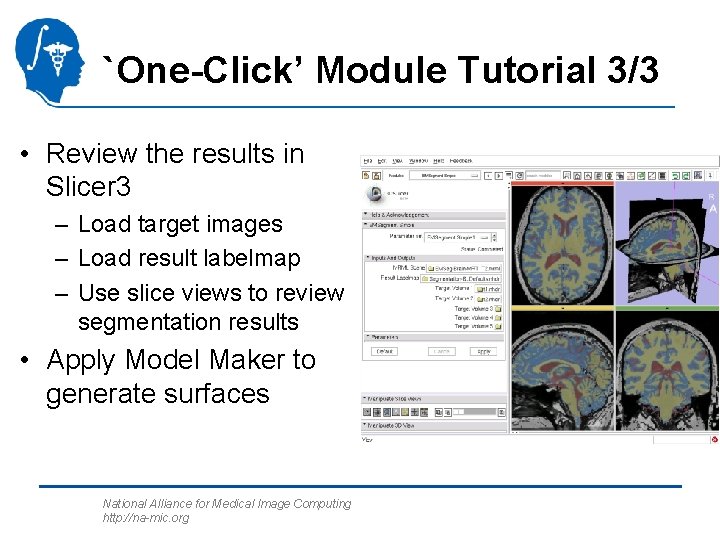 `One-Click’ Module Tutorial 3/3 • Review the results in Slicer 3 – Load target