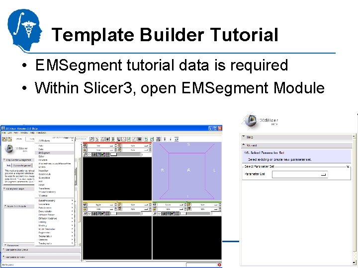 Template Builder Tutorial • EMSegment tutorial data is required • Within Slicer 3, open