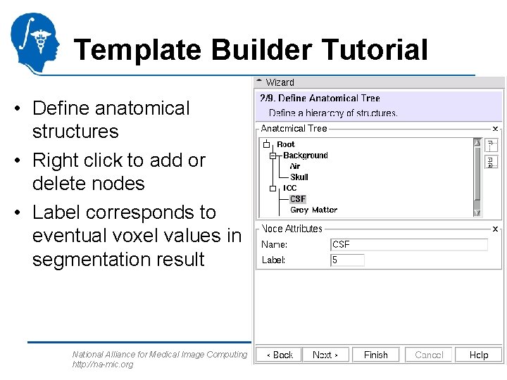 Template Builder Tutorial • Define anatomical structures • Right click to add or delete