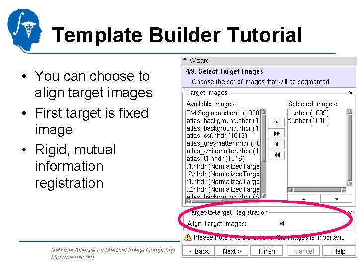 Template Builder Tutorial • You can choose to align target images • First target