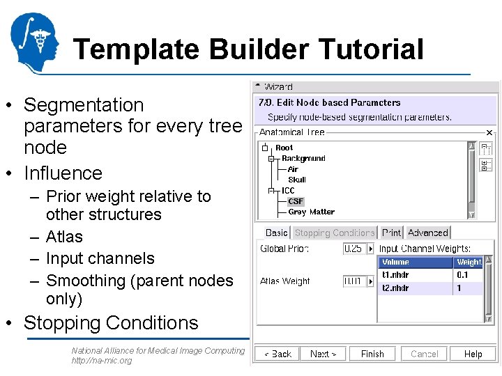 Template Builder Tutorial • Segmentation parameters for every tree node • Influence – Prior