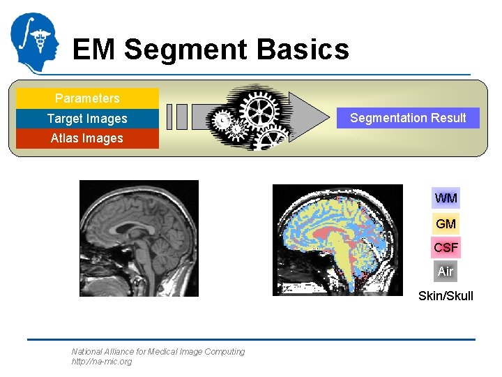 EM Segment Basics Parameters Target Images Segmentation Result Atlas Images WM GM CSF Air