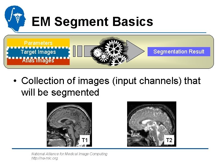 EM Segment Basics Parameters Segmentation Result Target Images Atlas Images • Collection of images