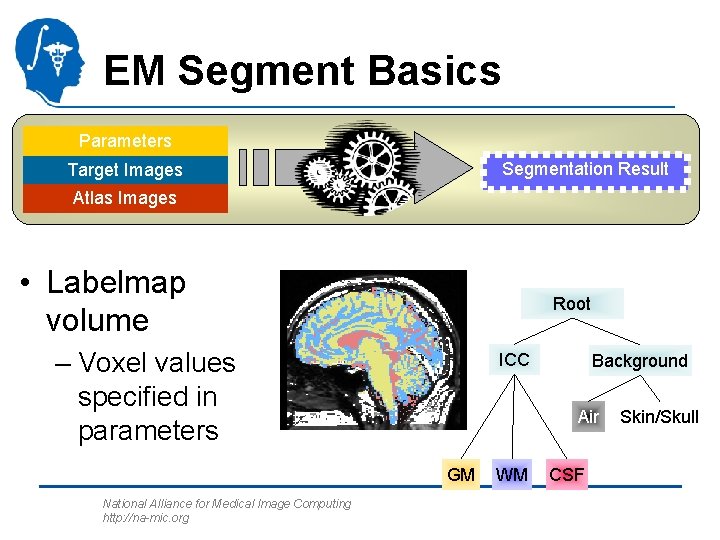 EM Segment Basics Parameters Segmentation Result Target Images Atlas Images • Labelmap volume Root