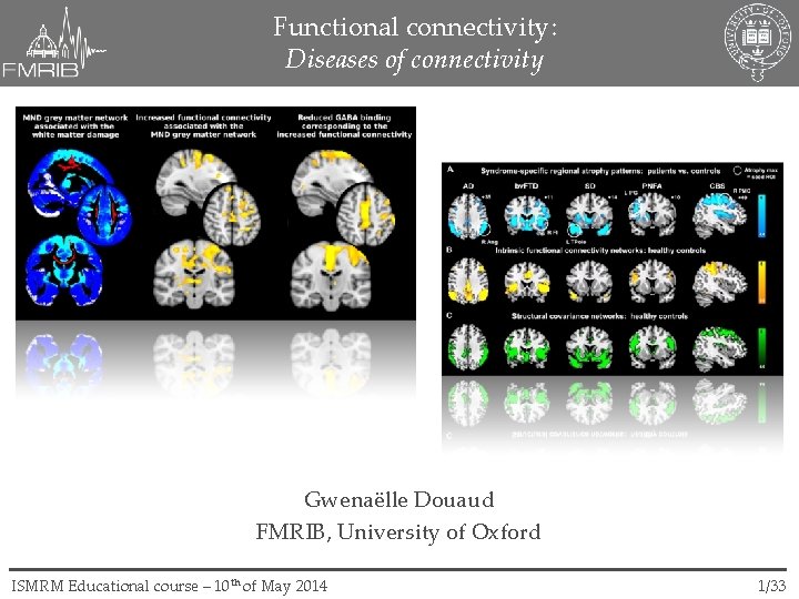 Functional connectivity: Diseases of connectivity Gwenaëlle Douaud FMRIB, University of Oxford ISMRM Educational course