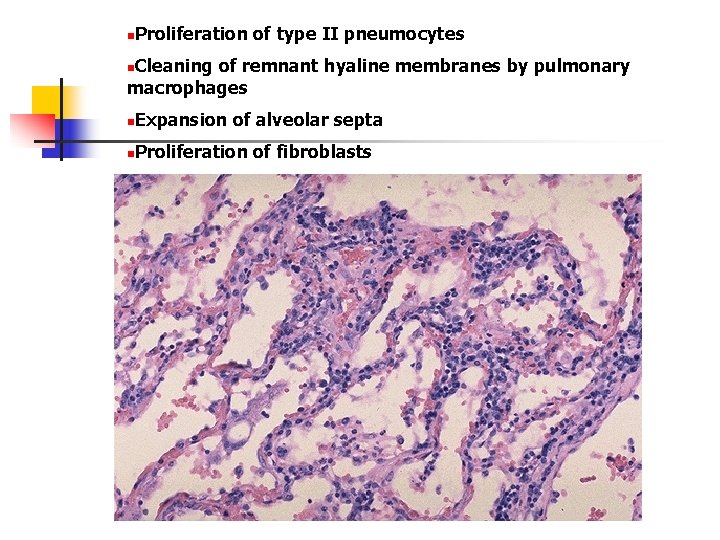 Proliferation of type II pneumocytes n Cleaning of remnant hyaline membranes by pulmonary macrophages