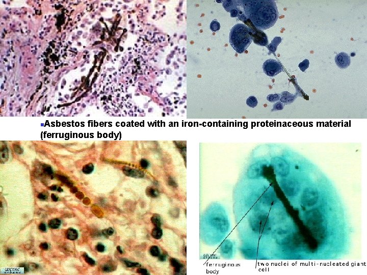 does colon cancer show up in bloodwork