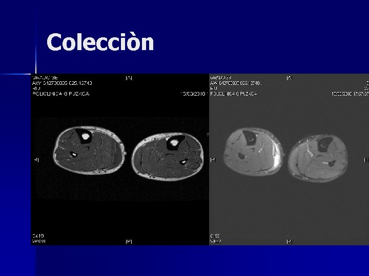 Colecciòn Colecciòn