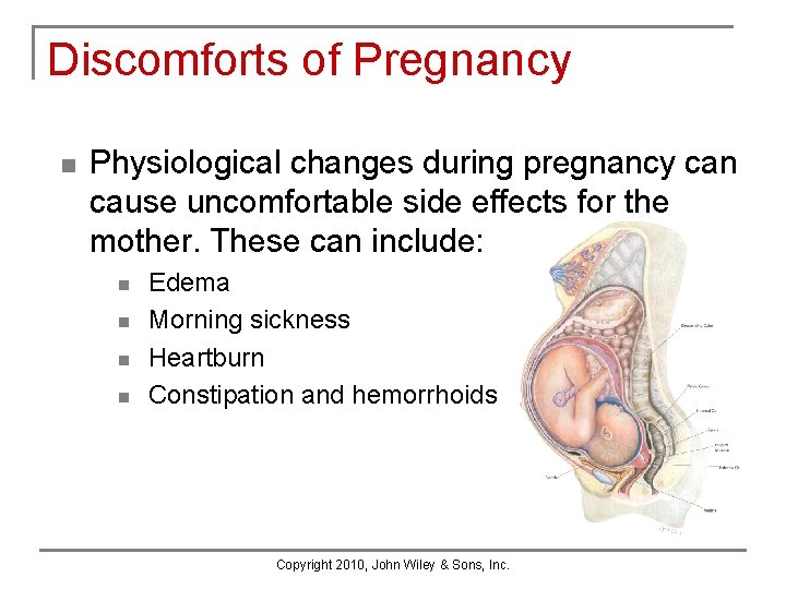 Discomforts of Pregnancy n Physiological changes during pregnancy can cause uncomfortable side effects for Discomforts of Pregnancy n Physiological changes during pregnancy can cause uncomfortable side effects for