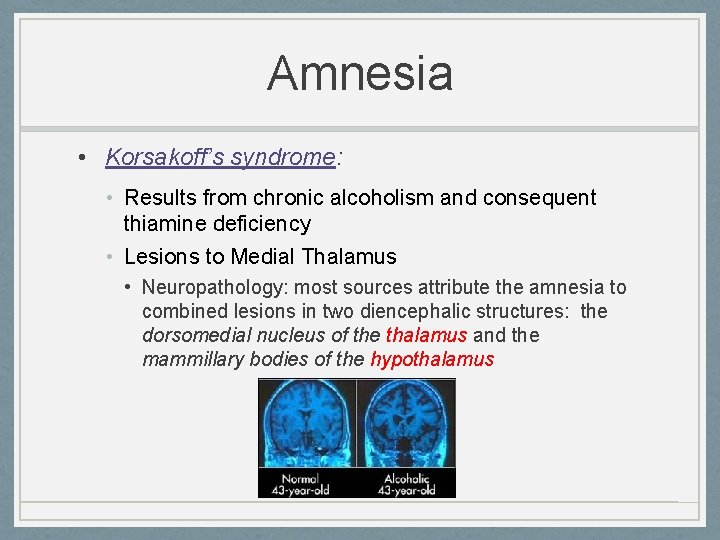 Amnesia • Korsakoff’s syndrome: • Results from chronic alcoholism and consequent thiamine deficiency •