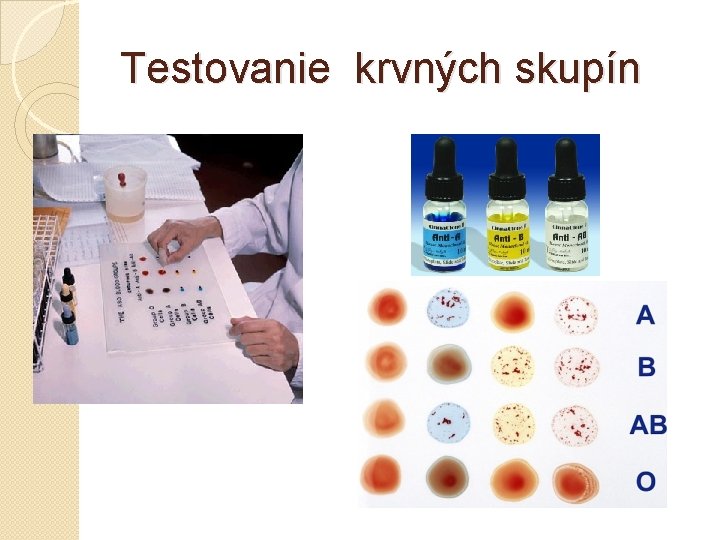 Testovanie krvných skupín 