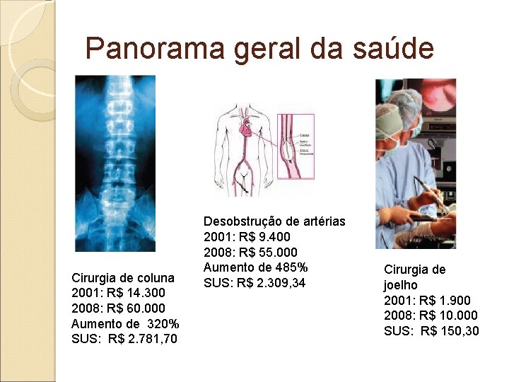 Panorama geral da saúde Cirurgia de coluna 2001: R$ 14. 300 2008: R$ 60.