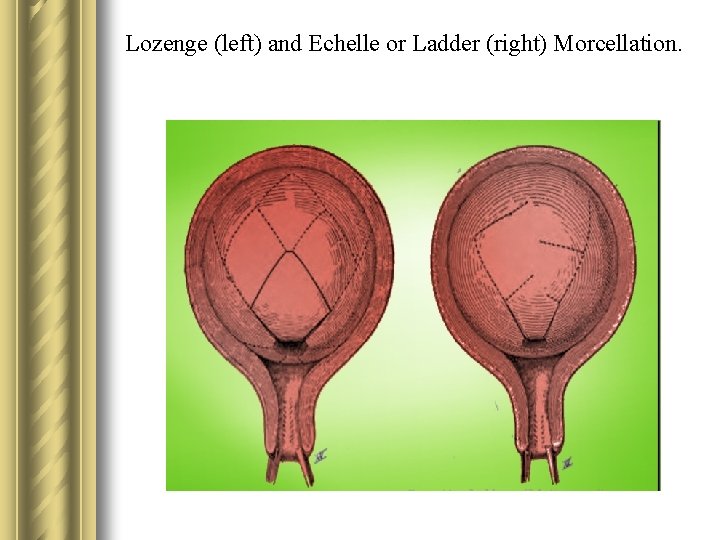 Lozenge (left) and Echelle or Ladder (right) Morcellation. 