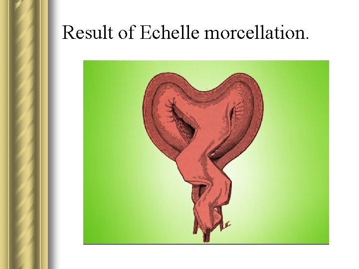 Result of Echelle morcellation. 