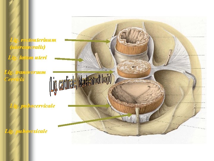 Lig. rectouterinum (uterosacralis) Lig. latum uteri Lig. transversum Cervicis Lig. pubocervicale Lig. pubovesicale 