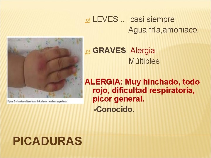  LEVES …. casi siempre Agua fría, amoniaco. GRAVES. . Alergia Múltiples ALERGIA: Muy