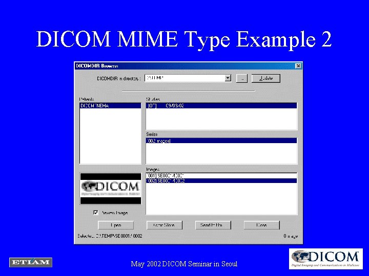 DICOM MIME Type Example 2 May 2002 DICOM Seminar in Seoul 