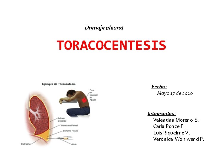 Drenaje pleural TORACOCENTESIS Fecha: Mayo 17 de 2010 Integrantes: Valentina Moreno S. Carla Ponce