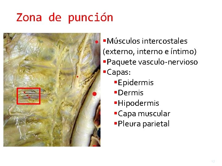 Zona de punción Músculos Espacio intercostales intercostal: 1 2 3 4 5 6 7