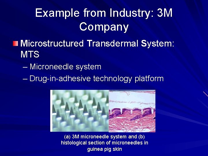 Example from Industry: 3 M Company Microstructured Transdermal System: MTS – Microneedle system –