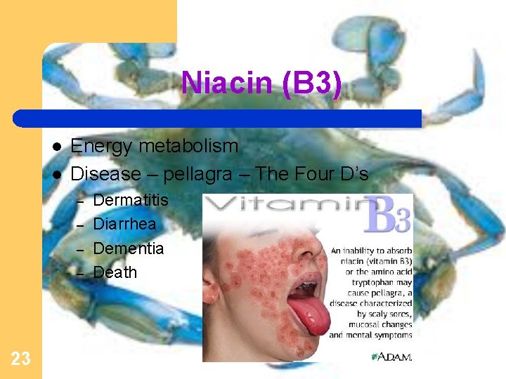Niacin (B 3) l l Energy metabolism Disease – pellagra – The Four D’s