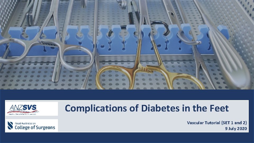 TITLE Complications of Diabetes in the Feet Vascular Tutorial (SET 1 and XXX) 2)