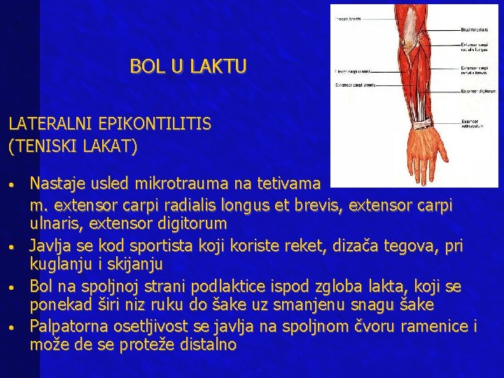 BOL U LAKTU LATERALNI EPIKONTILITIS (TENISKI LAKAT) • • Nastaje usled mikrotrauma na tetivama