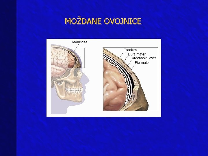 MOŽDANE OVOJNICE 