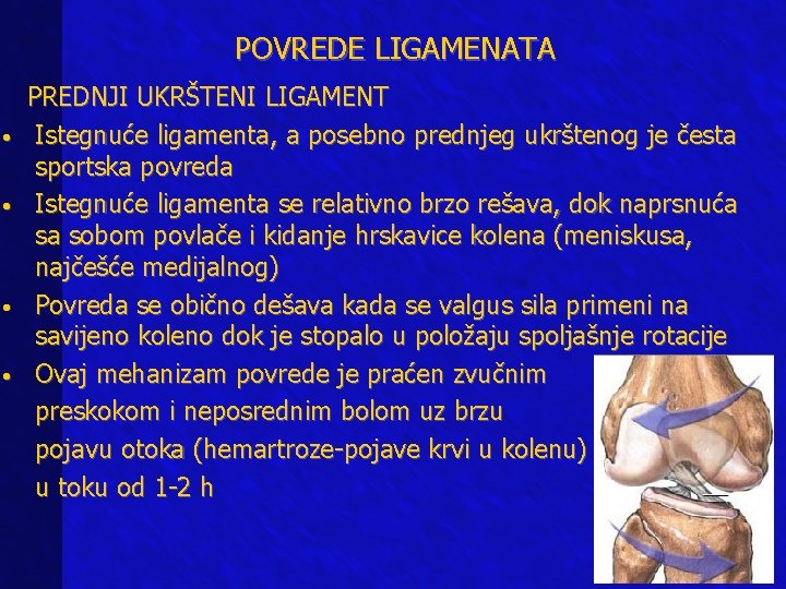 POVREDE LIGAMENATA PREDNJI UKRŠTENI LIGAMENT • Istegnuće ligamenta, a posebno prednjeg ukrštenog je česta